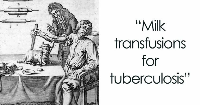 28 Terrifying Methods And Tools That Doctors Used In The Past To Treat Patients
