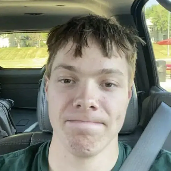 A young man with a messy, uneven haircut, looking directly at the camera with a neutral expression, showing bold hairstyles.