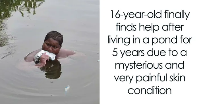 Teen Has Spent The Last 5 Years Inside A Pond, Doctors Left Stunned By His Mysterious Condition