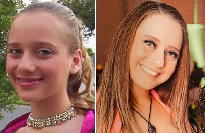 Side-by-side photos show a young girl with braces and an adult woman, both smiling, showing people changed for the better.