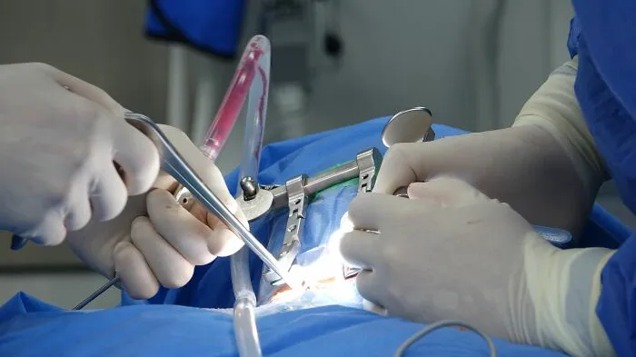 “They Told Me It Wouldn’t Be That Bad”: 62 People Share Extremely Painful Medical Procedures