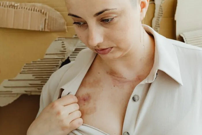 “They Told Me It Wouldn’t Be That Bad”: 62 People Share Extremely Painful Medical Procedures