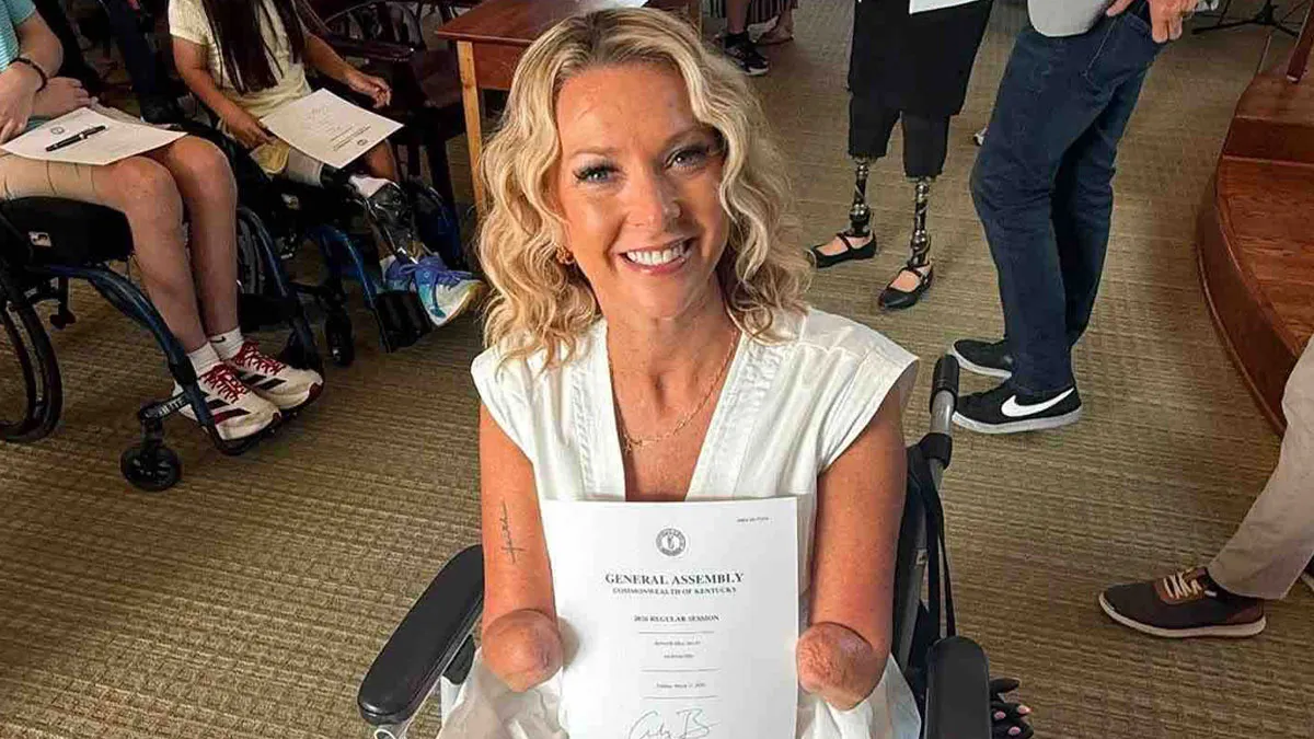 Woman Woke Up Without Her Limbs After Routine Surgery And Told Doctors She Was Fine With It