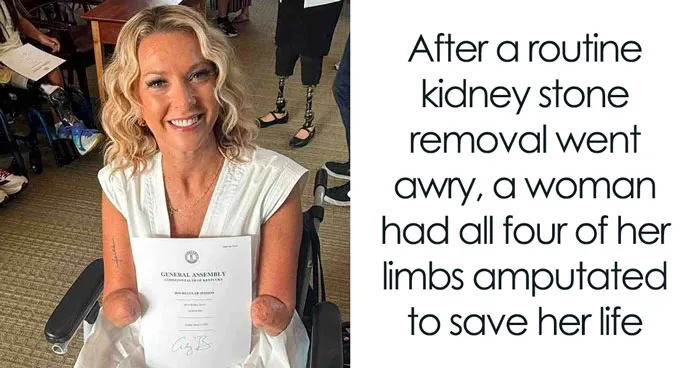 Woman Woke Up Without Her Limbs After Routine Surgery And Told Doctors She Was Fine With It