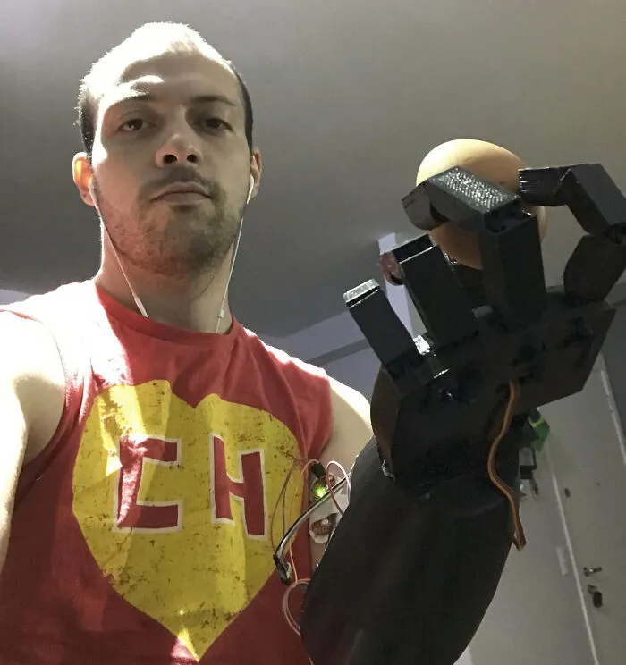Was Born Without An Arm So I Built Myself My Own Eletronic 3D Printed Arm. This Is Me Holding An Egg
