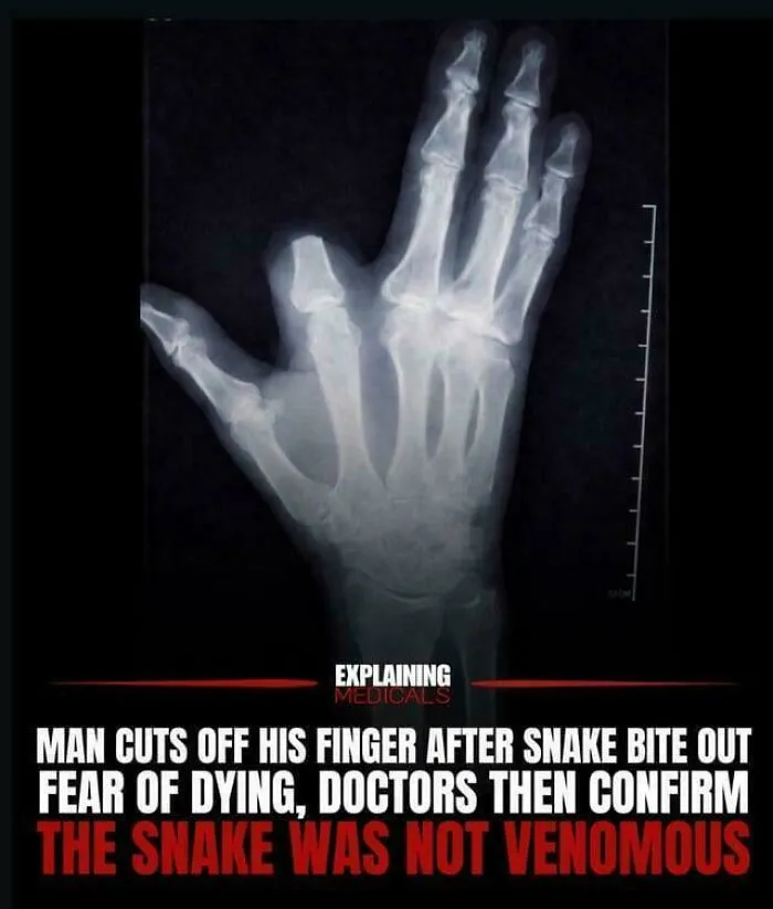 Snakes: 0 | Panic: 1 Finger