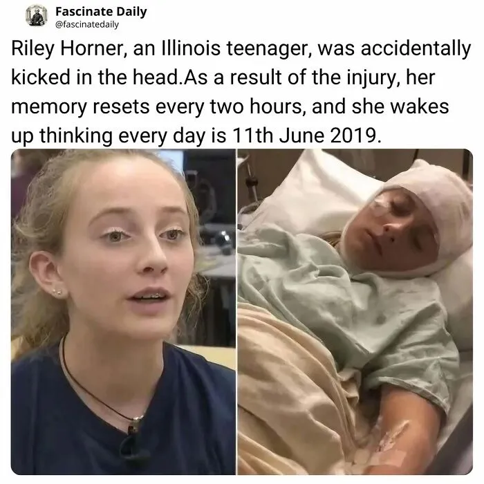 Riley Horner's memory resets every two hours after head injury memory loss story