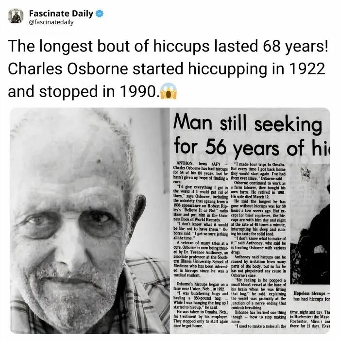 Man with longest bout of hiccups lasting 68 years Charles Osborne