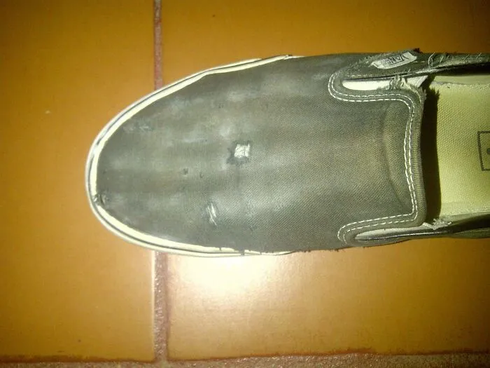 Moving Around Dumbells With My Foot Wore My Shoes Into Showing My Foots Skeletal Pattern