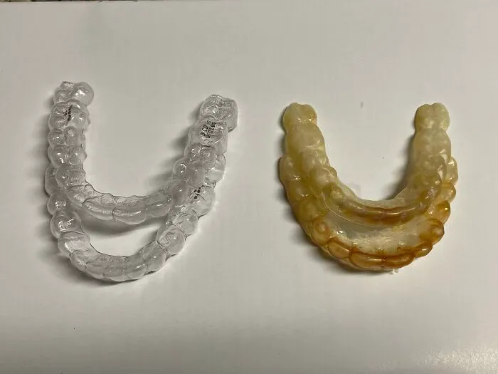 New Retainer vs. Old Retainer