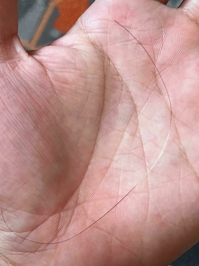 My Hair Strand That Turned Gray Halfway Then Got Its Color Back