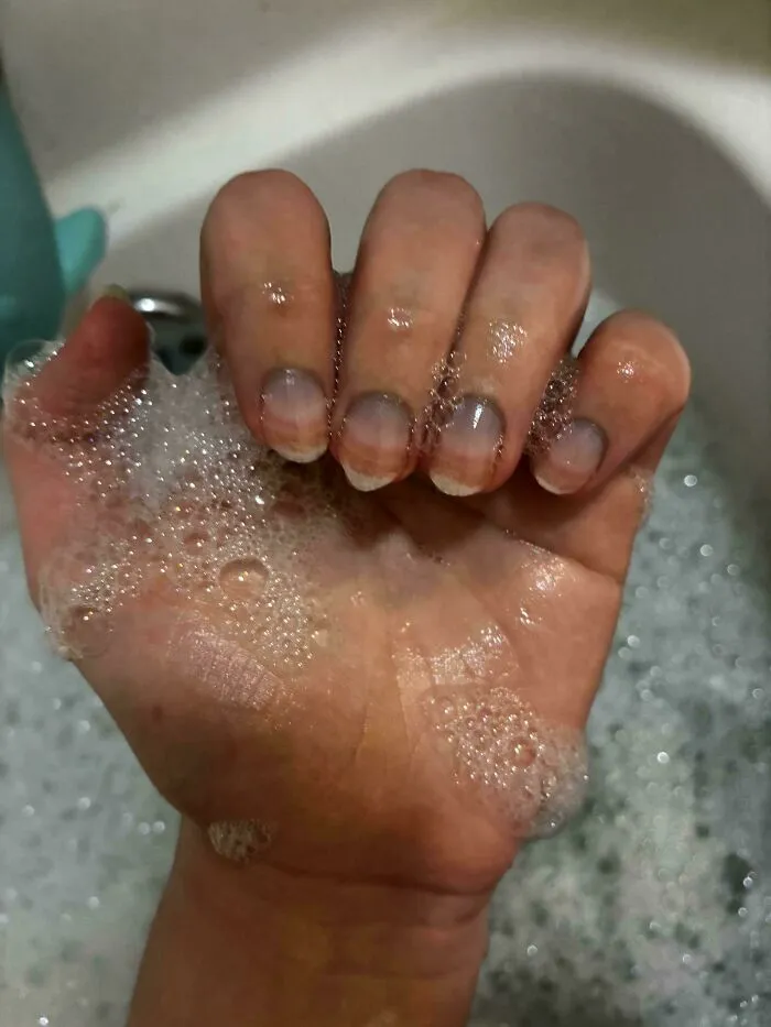 Me metí en un baño de burbujas demasiado caliente y mis uñas hicieron un degradado
