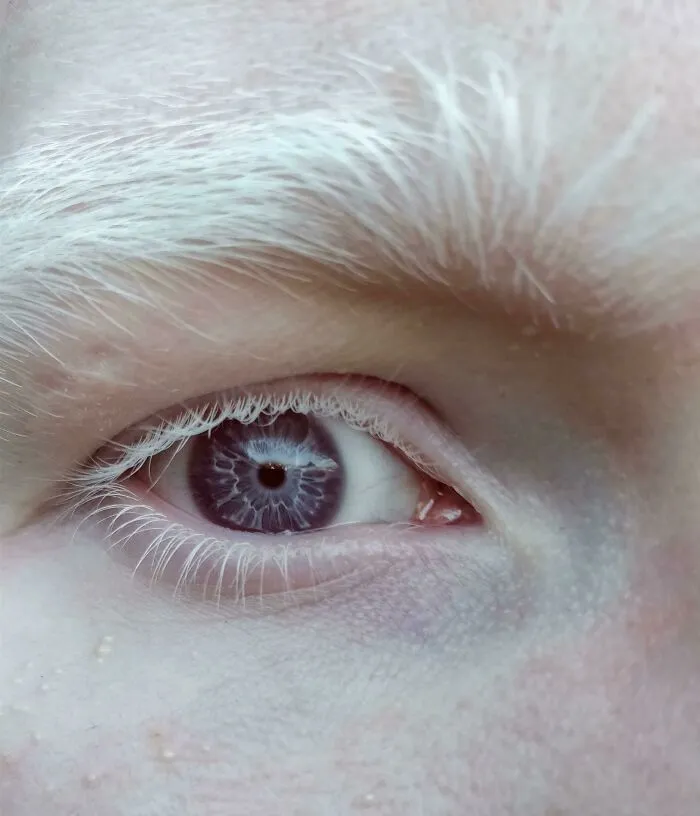 I Have Purple Eyes