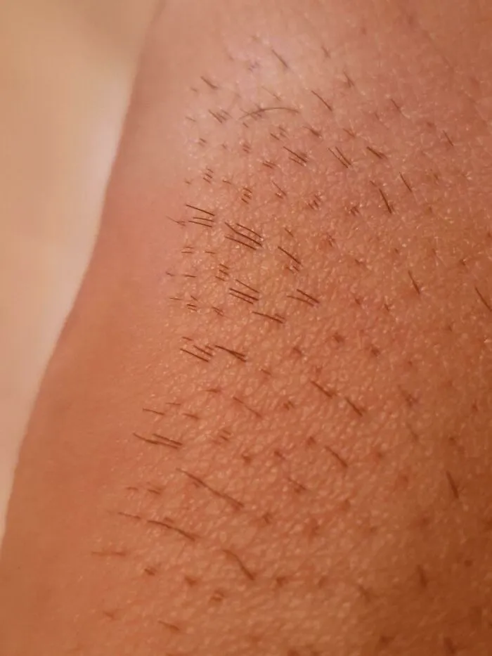 El vello de mi cuerpo crece de 3 en 3