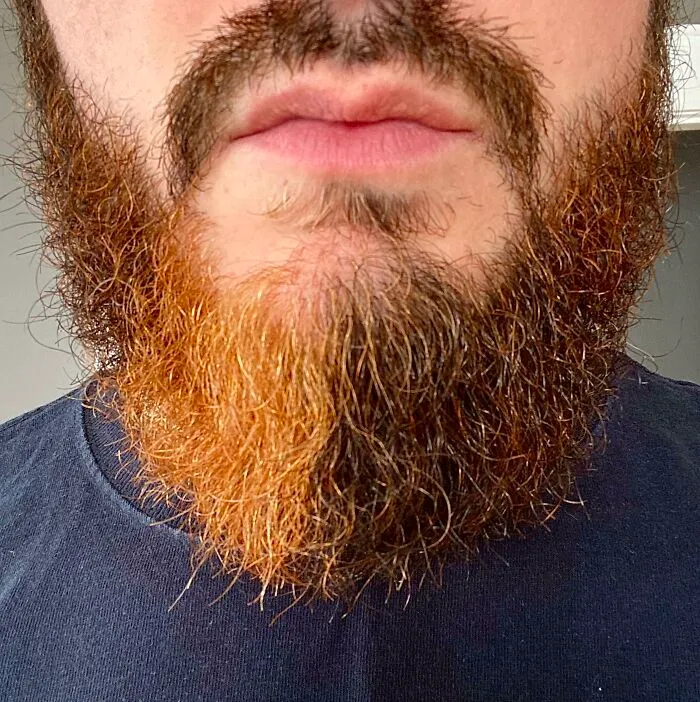 Mi barba me crece una cuarta parte de color naranja y se divide justo por la mitad de la barbilla (hasta llega al labio inferior)