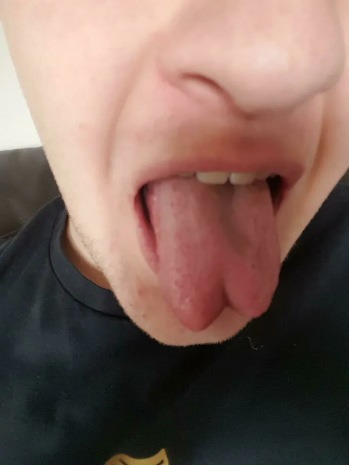 Mi lengua es bífida de forma natural