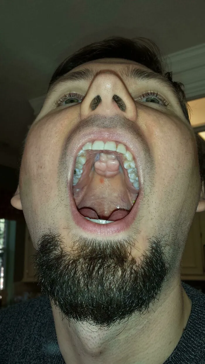 We Call It His Spare Brain