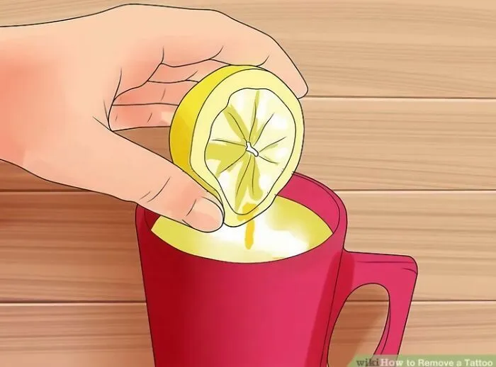 How To Remove A Tattoo