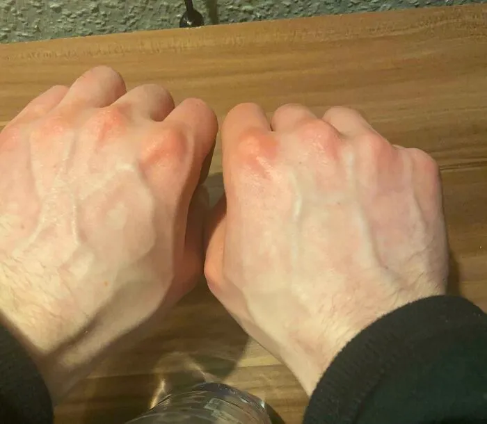 Rare hand veins pattern on two fists showing unique physical features
