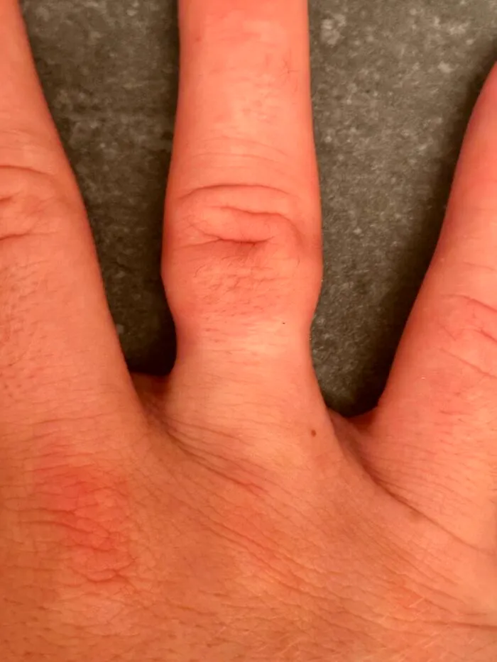 Close-up of hand with rare double jointed finger bending backward