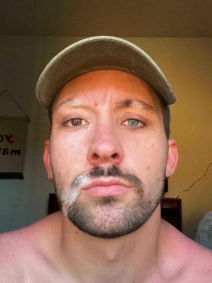 Man with heterochromia and unique facial hair showing rare physical features