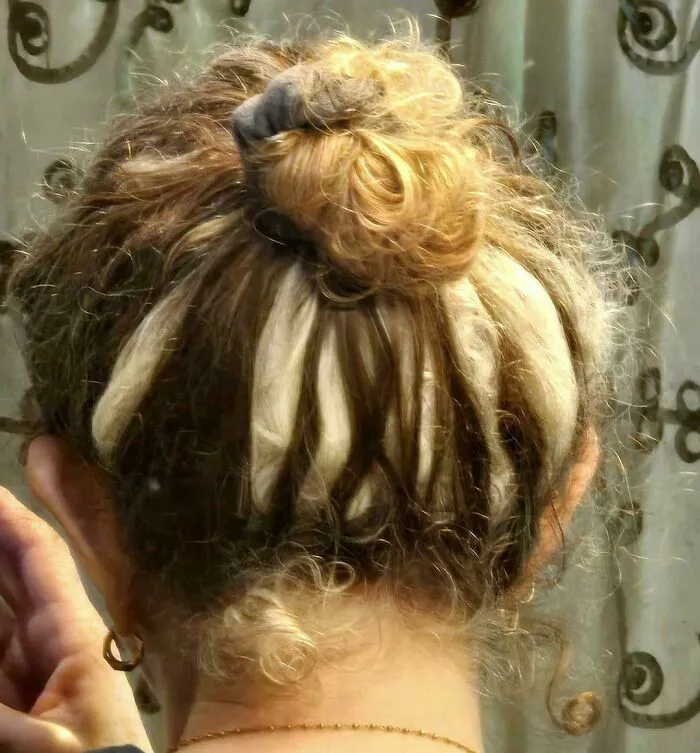 Woman with rare physical features showing patchy blond and dark hair tied in a bun