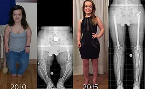 69 Side-By-Side Comparisons Showing Things And People Changing Drastically