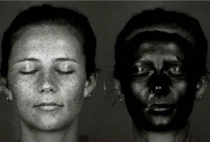 UV Photo Of Face Before And After Applying Sunscreen