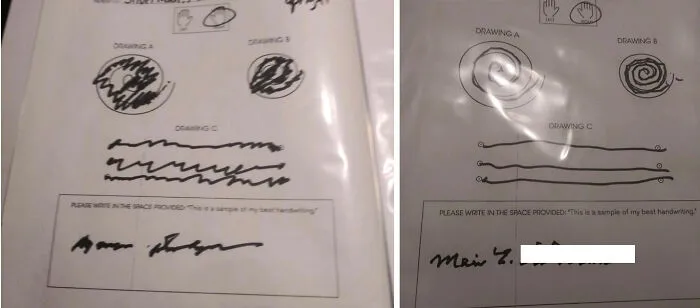 My 90yo Grandmothers Handwriting Before And After Her Focused Ultrasound Essential Tremor Treatment