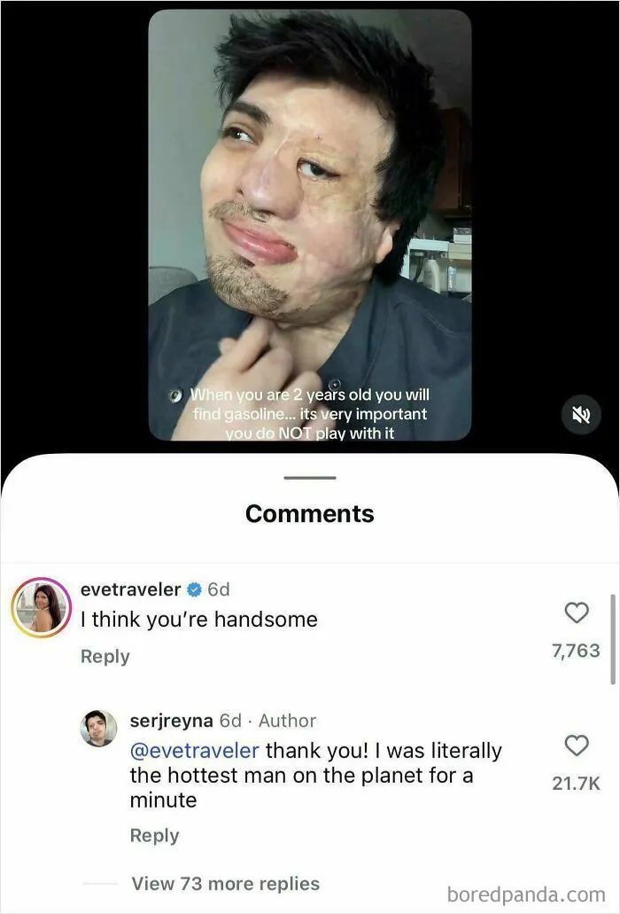 Cursed_burn Victim