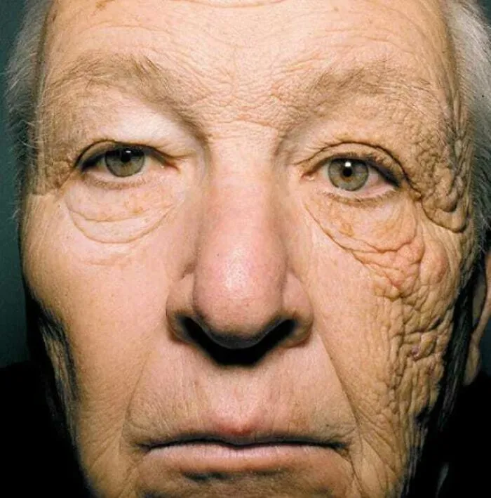 A closeup portrait showing how time slowly reshapes a man's face from sun exposure
