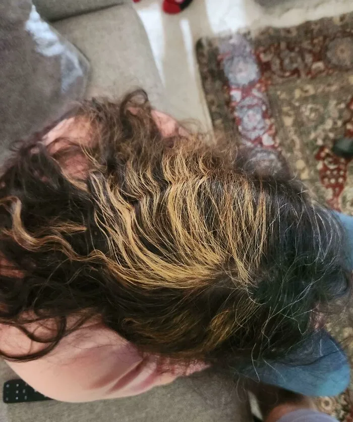 Overhead view of a person with uneven and patchy hair dye, an example of beauty procedures fails.