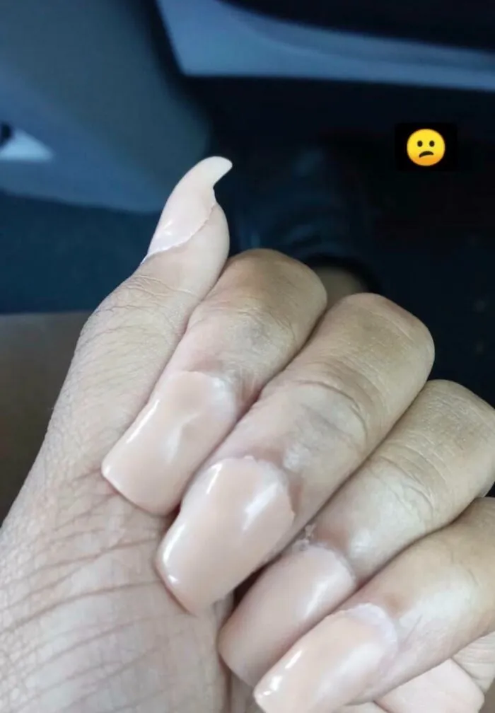 Extremely thick and unevenly shaped beige acrylic nails showcasing beauty procedures fails.