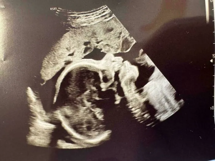 An ultrasound scan image showing a baby, celebrating the journey of wholesome dads during pregnancy.