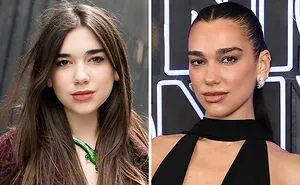 10 Famous People Who "Looksmaxxed" Throughout The Years, As Plastic Surgeons Hint At Procedures
