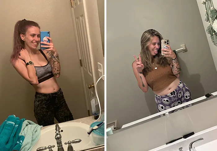 2021 vs. 2026 - Spent Years Unable To Gain Weight/Get Above 90lbs And Struggled With Purging, But I've Been Steady 135lbs+ For The Last Few Years