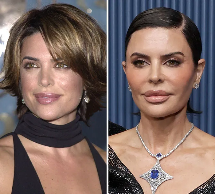 Lisa Rinna