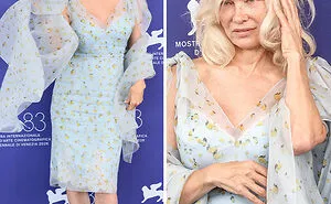 "Wash Your Hair": 15 Worst Dressed Celebrities At The 2026 Venice Film Festival Red Carpet