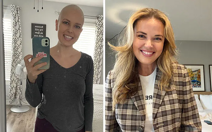 First Round Of Chemo & 5 Years Cancer Free
