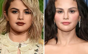 “Hope She Fired That Plastic Surgeon”: 15 Hollywood Stars Sparked Plastic Surgery Claims At The 2026 Emmys