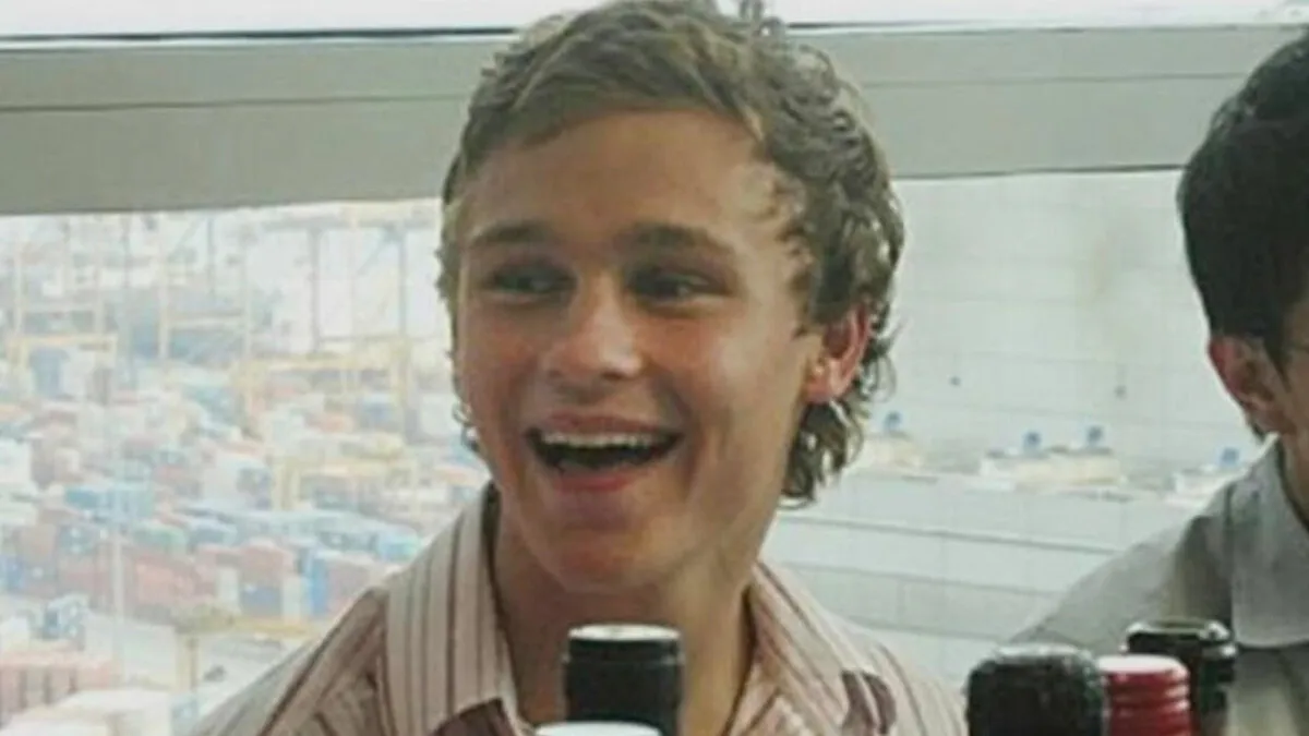 19YO Challenged To Eat A Slug Ends Up Facing A Medical Nightmare Beyond Anyone’s Imagination
