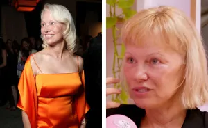 "Around 10 Years To Live": Pamela Anderson Reveals Details Of Her Harrowing Health Battle
