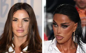 Katie Price Sparks Concern With Latest Appearance After Having Corrective Surgery