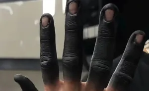 Viral Fingertip Tattoo Trend Hit With Chilling Warnings From Doctors Over The Risks Involved