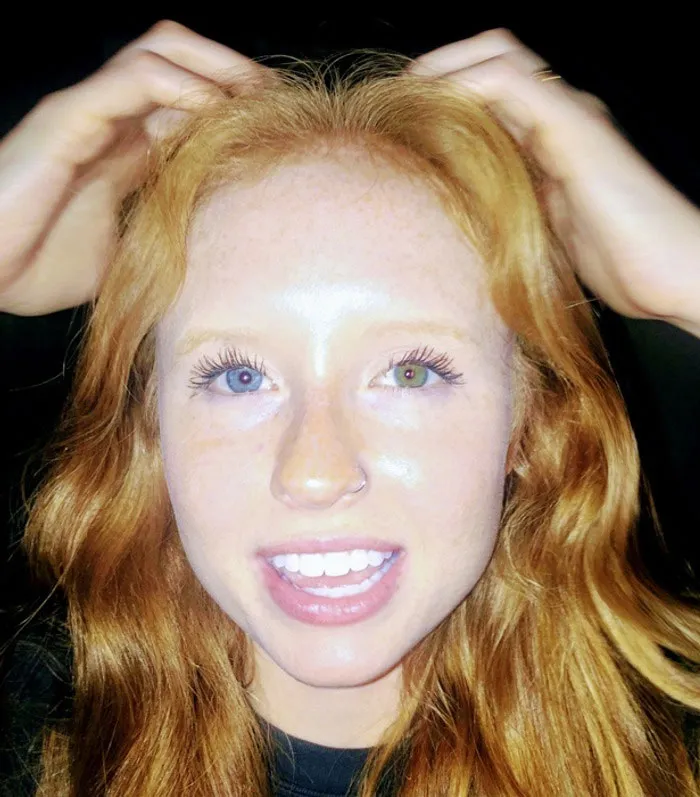 My Sister Is A Ginger And Has Heterochromia. A Genetic Masterpiece!