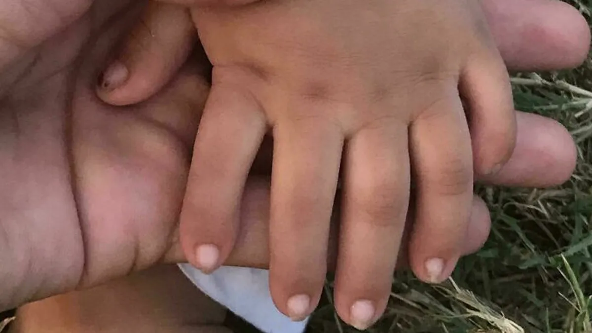 “40 Years Of Hiding These”: 85 Surprising Body Features That Make People Stand Out