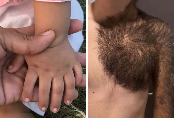 “40 Years Of Hiding These”: 85 Surprising Body Features That Make People Stand Out