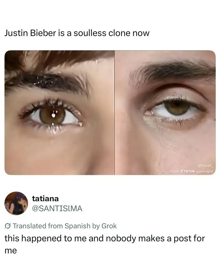 Close-up comparison of Justin Bieber's eyes showing difference in expression
