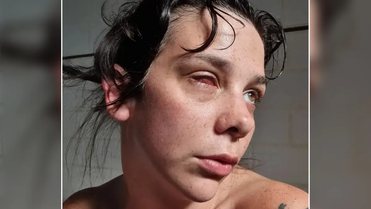 Woman Thought A Hangover Was To Blame For Her Blurry Vision, Then Doctors Gave Her Shocking News