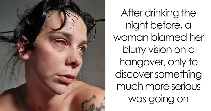 Woman Thought A Hangover Was To Blame For Her Blurry Vision, Then Doctors Gave Her Shocking News
